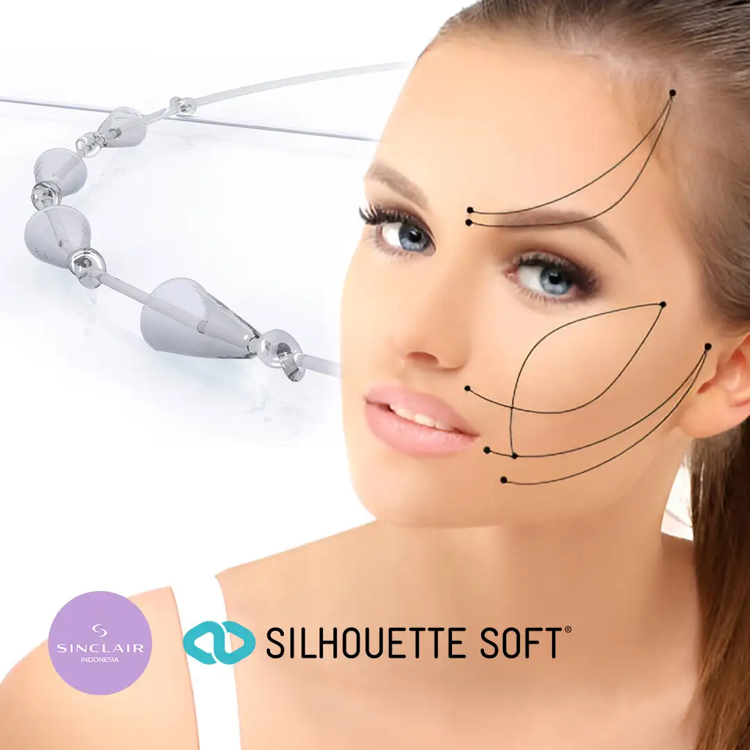 Mengapa Memilih Silhouette Soft Untuk Thread Lifting Tanam Benang Wajah?
