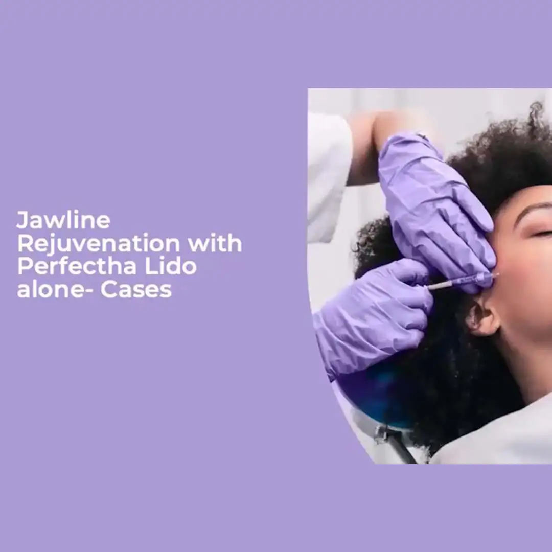 Webinar Creating the Social Media Jawline by combining HA Filler and Dynamic Cone Threads