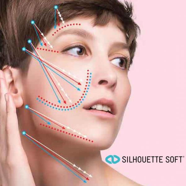 Kenali 5 Area Wajah yang Sering Jadi Sasaran Thread Lift