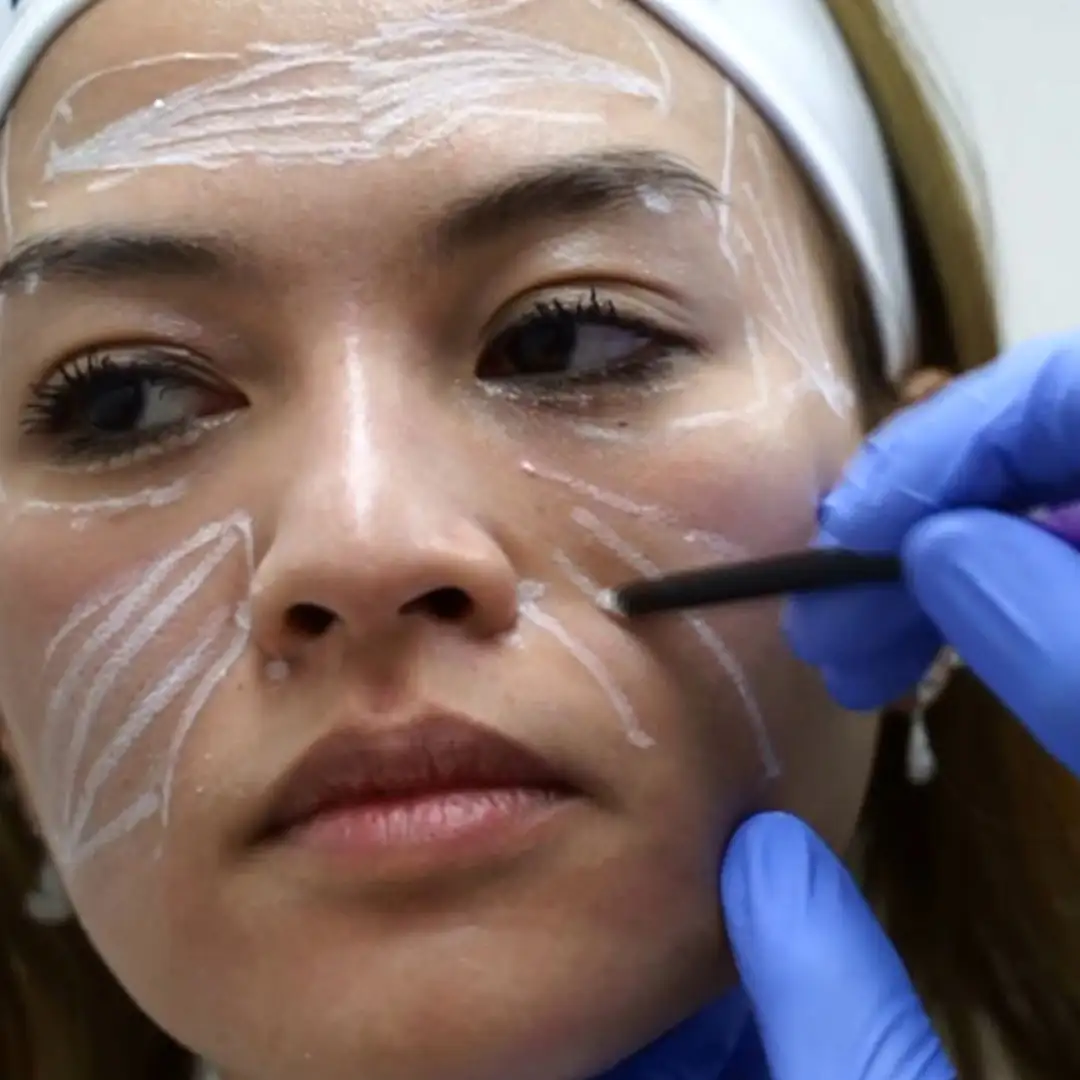 Webinar The Secret of Facial Rejuvenation with European Collagen Stimulating Filler