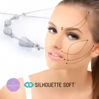 Mengapa Memilih Silhouette Soft Untuk Thread Lifting Tanam Benang Wajah?