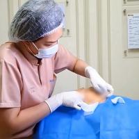 Threadlift Silhouette Soft by VIV Clinic