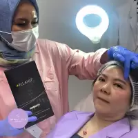 Kembalikan Kepadatan Alami Dahi, Solusi Awet Muda dengan Ellanse